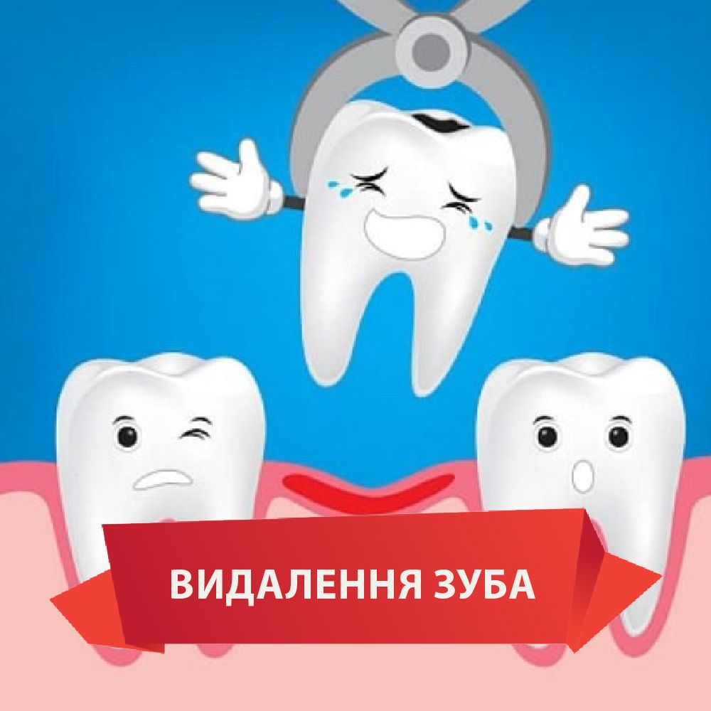 Безкоштовне видалення зуба*